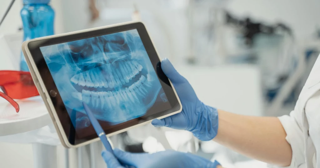 terapia stomatologiczna Stawy skroniowo-żuchwowe